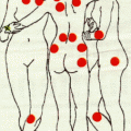 Traitement naturel Fibromylagie - Détoxication métaux lourds, décontraction musculaire, action antalgique - FM Pack- Labosp.com