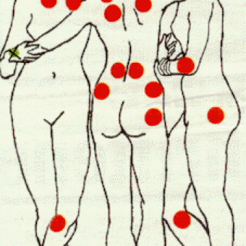 Traitement naturel Fibromylagie - Détoxication métaux lourds, décontraction musculaire, action antalgique - FM Pack- Labosp.com